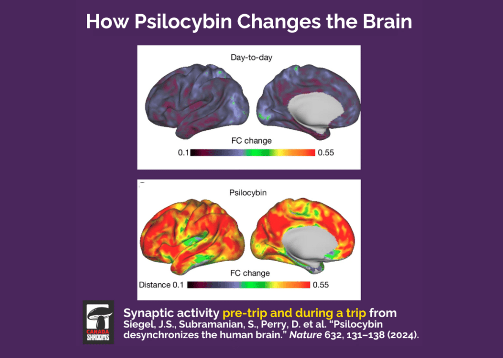 How psilocybin changes the brain graphic with images of brain